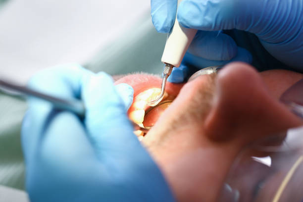 Best Emergency Treatment for Oral Infections in Traer, IA